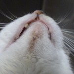 フィーラインアクネ例①