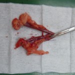 子宮（通常） のコピー